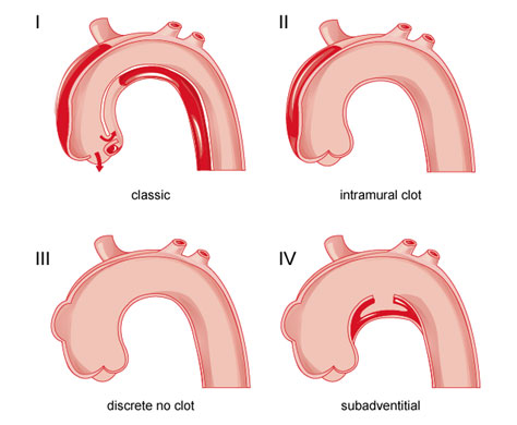 Medical Illustration