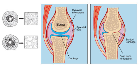 Medical Illustration